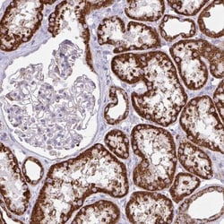 TVP23A Antibody, Novus Biologicals 0.1mL; Unlabeled:Antibodies, Polyclonal